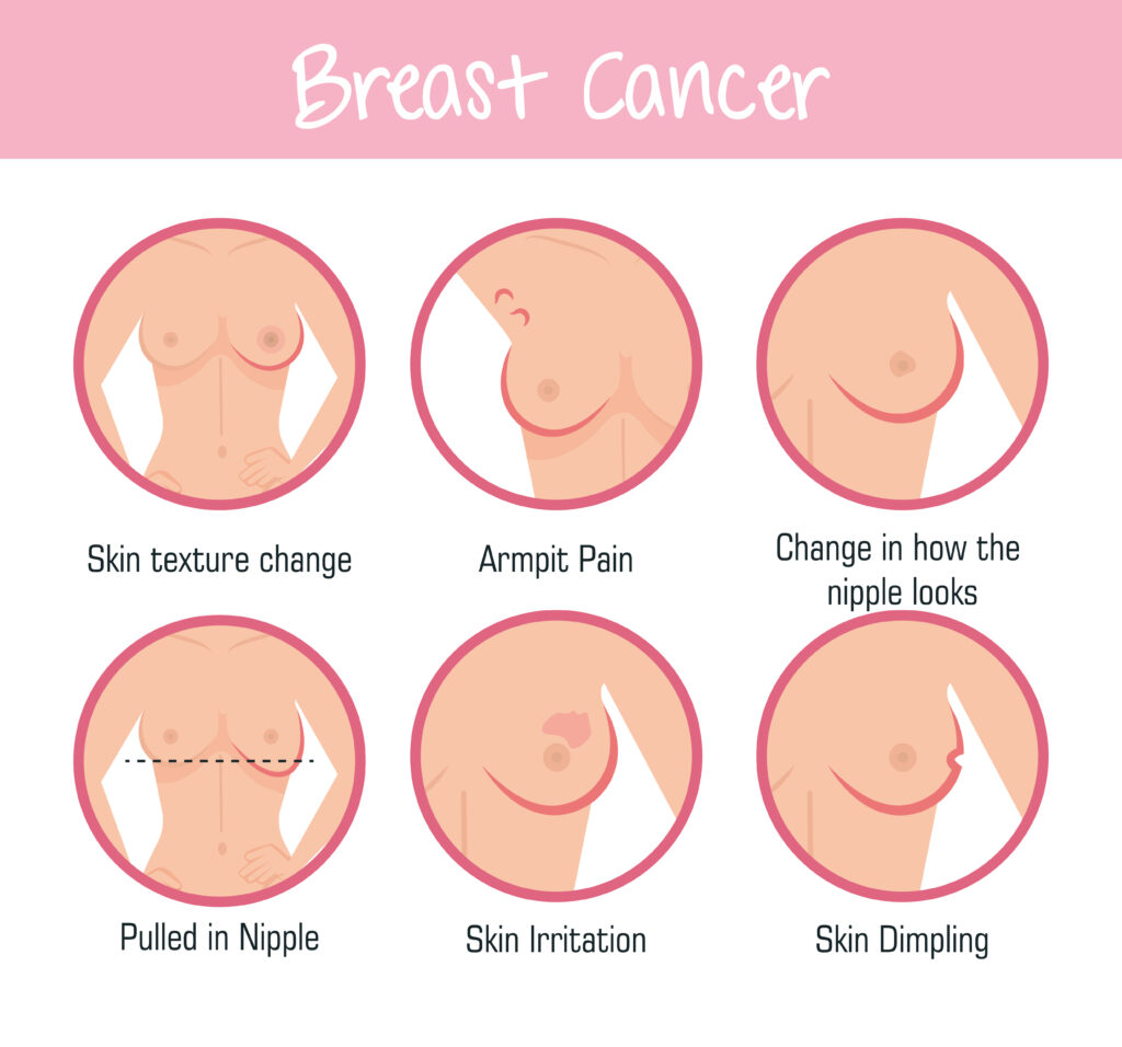 स्तन कोमलता कैसे ठीक करें